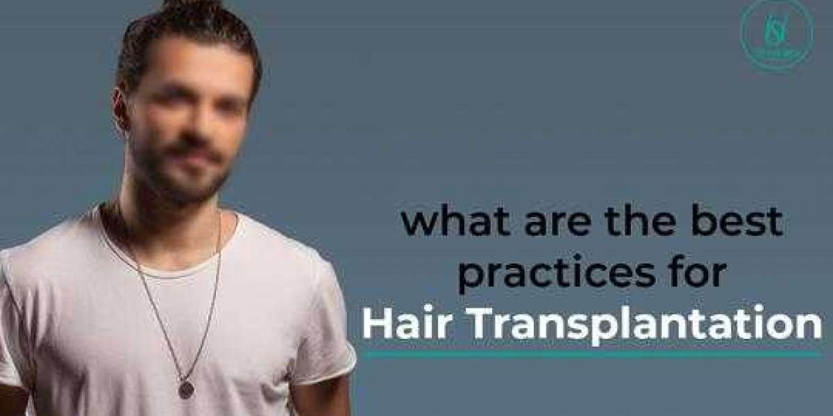Hair Loss Treatment in Delhi - Hairsmith
