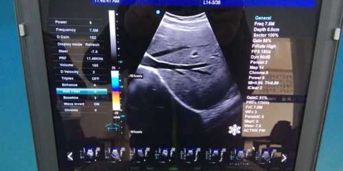 When asked how much an ultrasound machine will cost in 2022 medical facilities are likely to be interested in knowing th