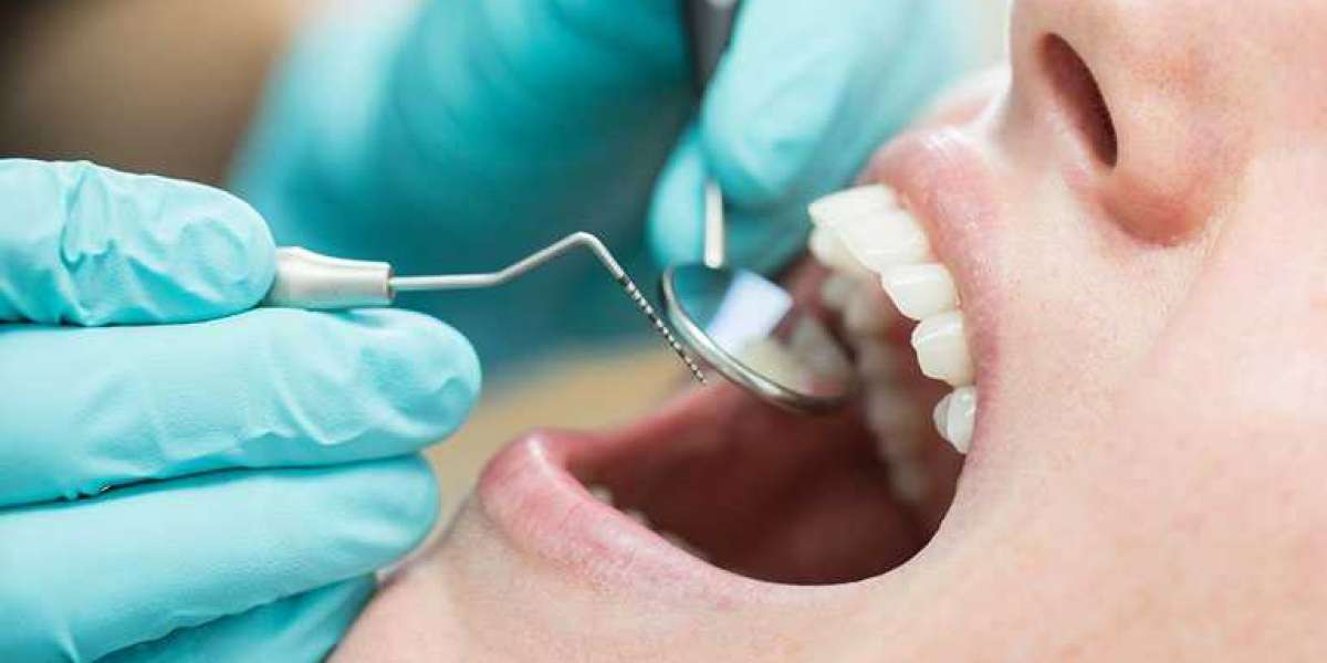 Is a Root Canal Considered Oral Surgery?