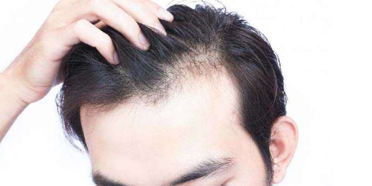 Want to know about hair loss treatment