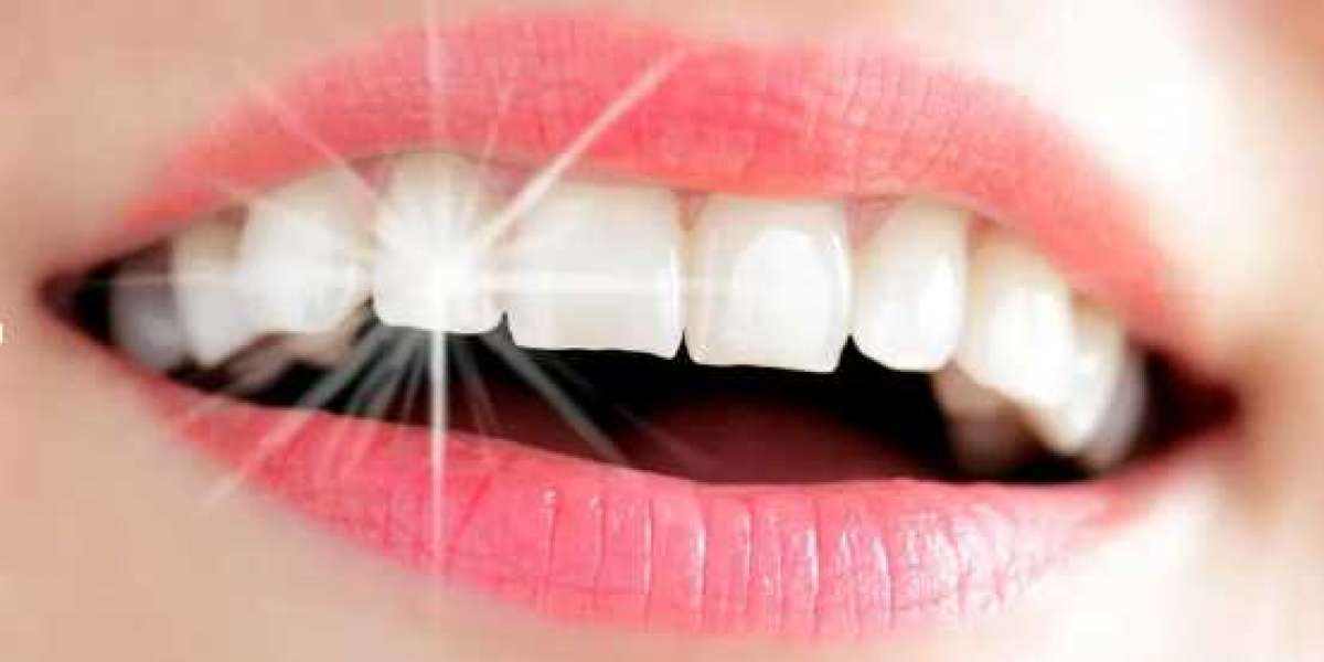 How to Achieve Clean White Teeth
