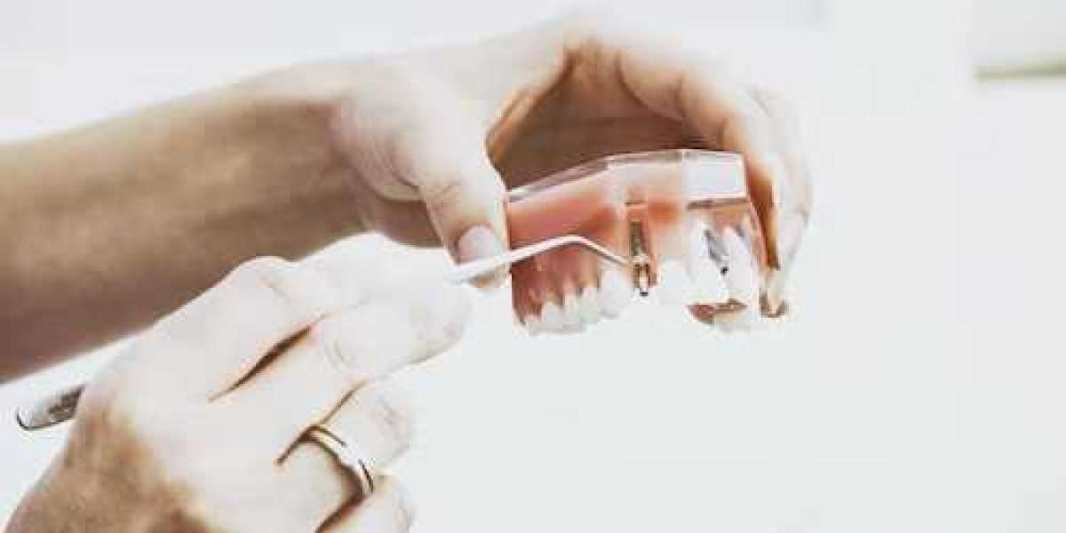 Why Did Your Adult Tooth Fall Off?
