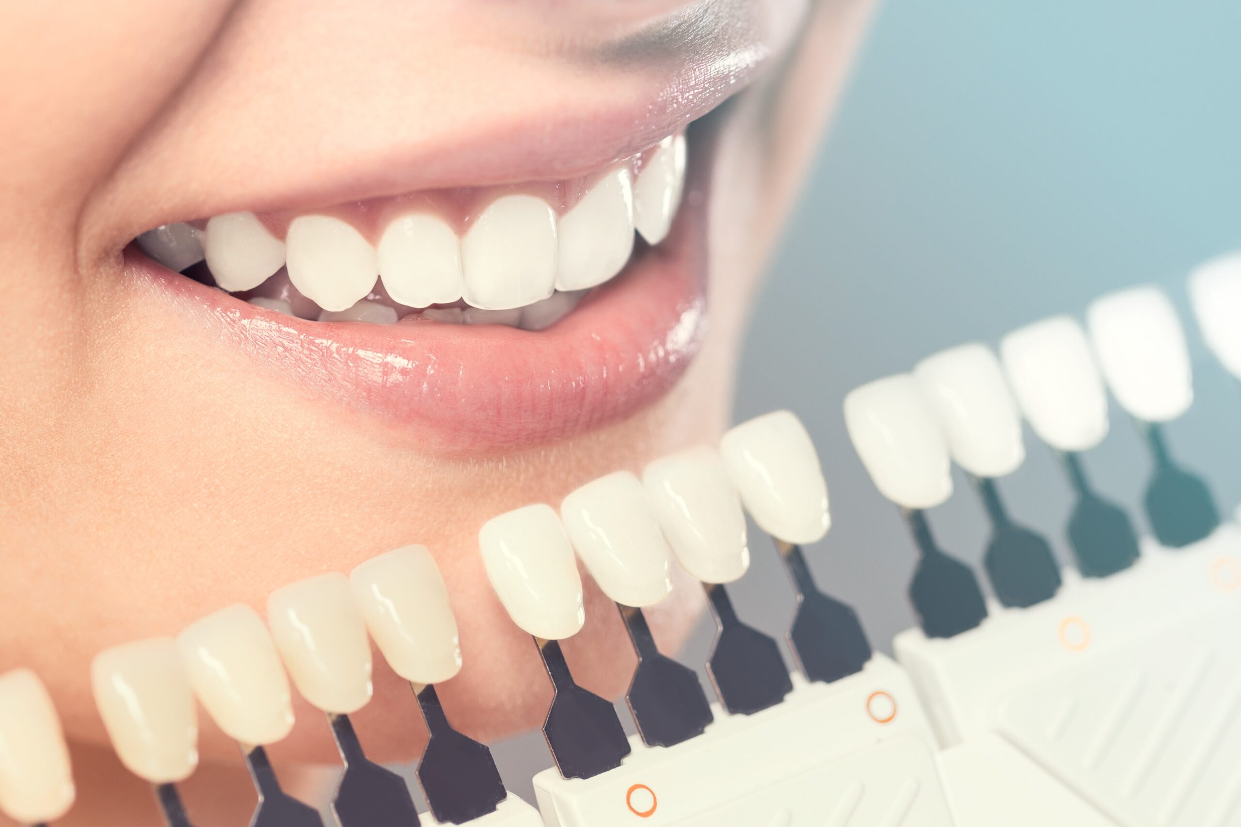 Common Misconceptions About Porcelain Veneers: Debunking Myths - Read News Blog